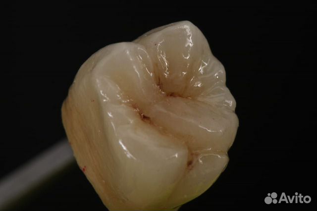 Зубной техник