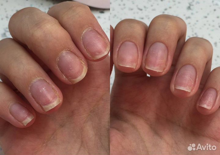 Маникюр, наращивание, педикюр