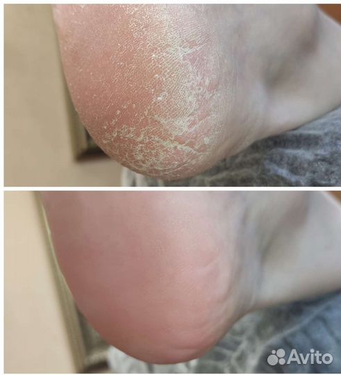 Подолог с выездом на дом