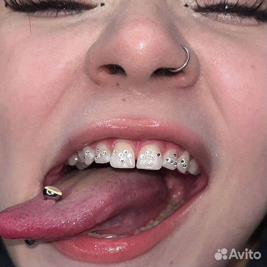 Скайсы / косметическое осветление зубов