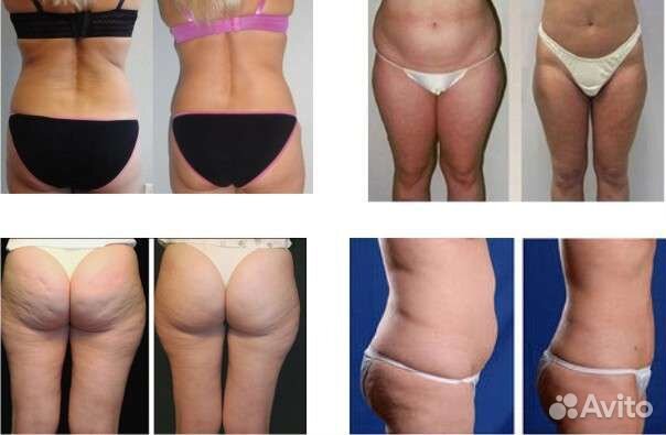 Массаж & LPG г.Москва. Здоровье и красота