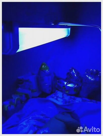 Лампа от желтушки, аренда продажа