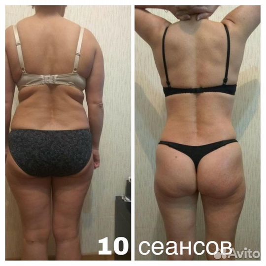 Массаж Всеволожск