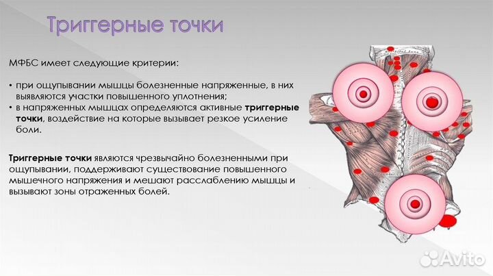 Триггерный Массаж, классический массаж