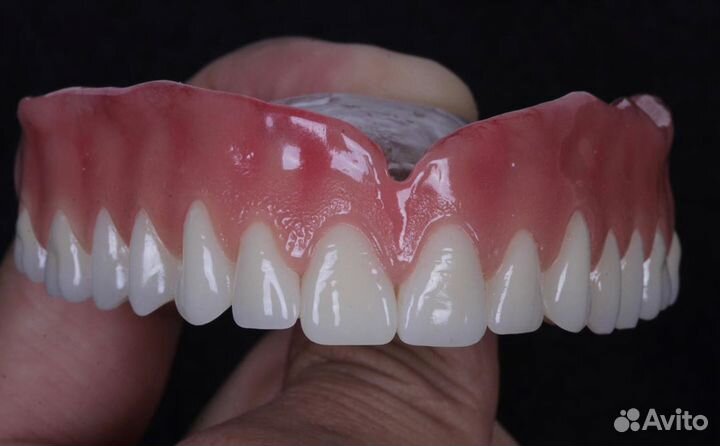 Изготовление зубных протезов с выездом на дом