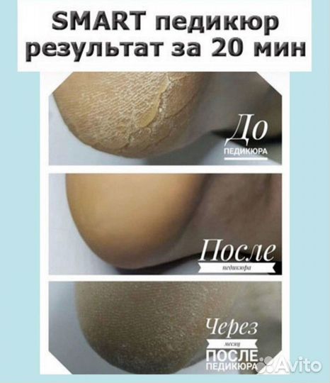 Ищу Модель на SMART Педикюр с покрытием