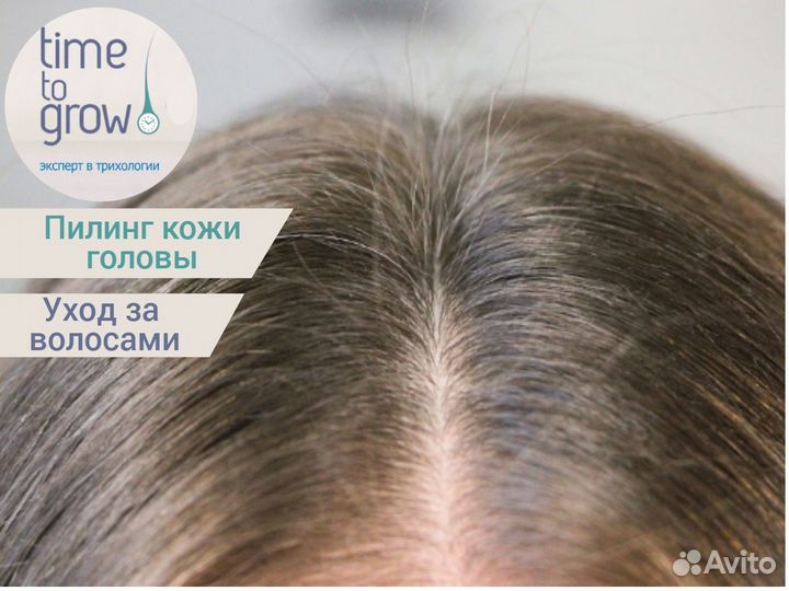 Пилинг для кожи головы Time to grow