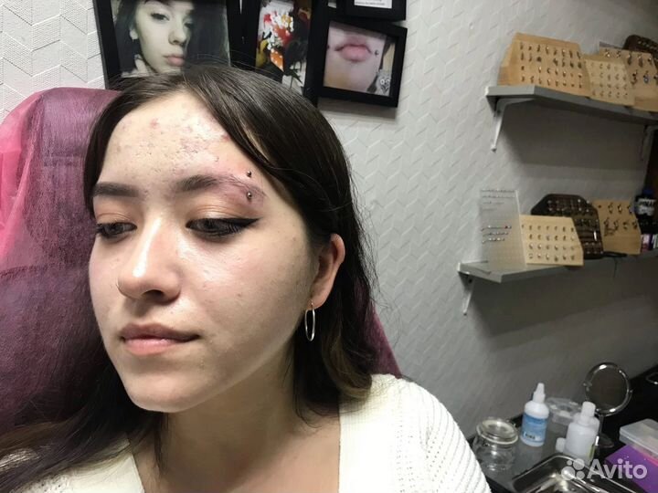 Пирсинг микродермал Эколь