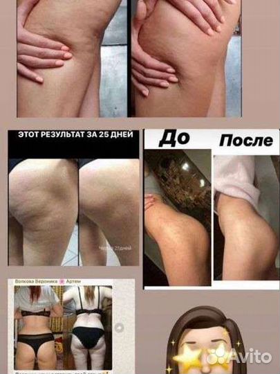 Антицеллюлитный гель