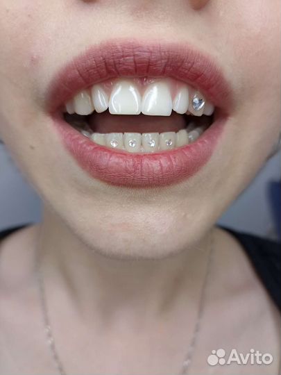 Скайсы, стразы на зубы
