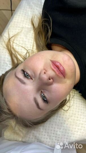 Вкусные губы корекция увеличение пластика губ