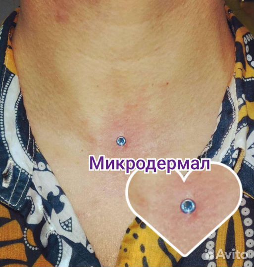 Прокол ушей/Пирсинг