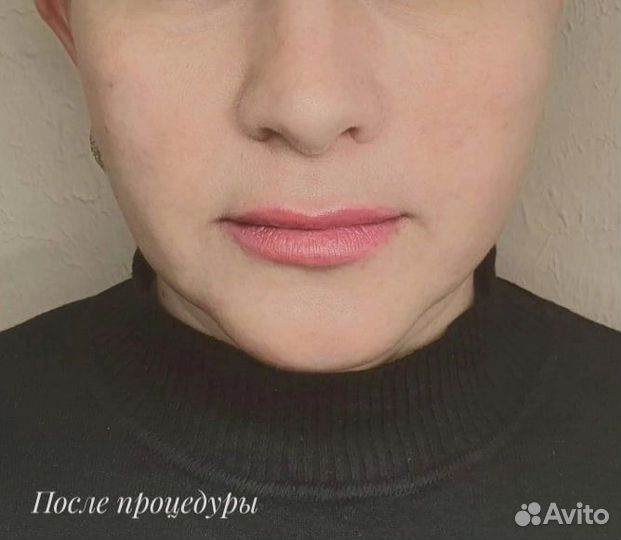 Услуги косметолога