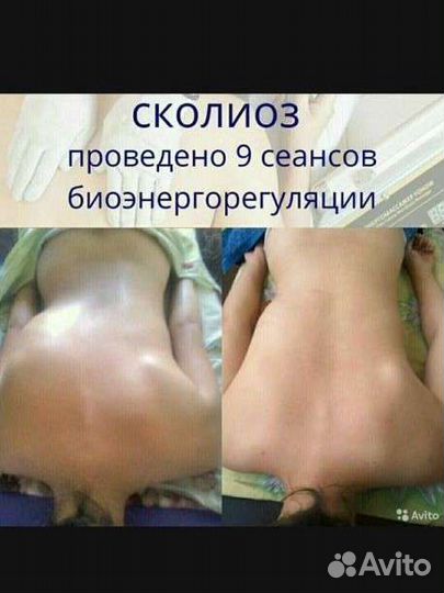 Массаж на биоэнергомассажере Fohow. Марма массаж