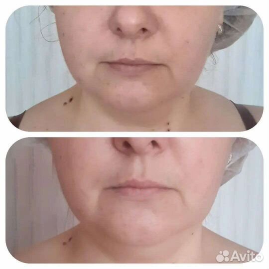 Коррекция лица и тела