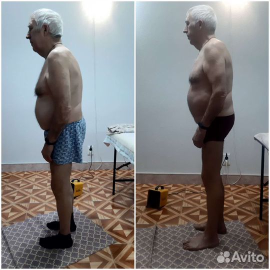 Биоэнергомассаж