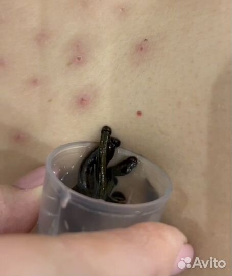 Пиявки медицинские с доставкой по всей России