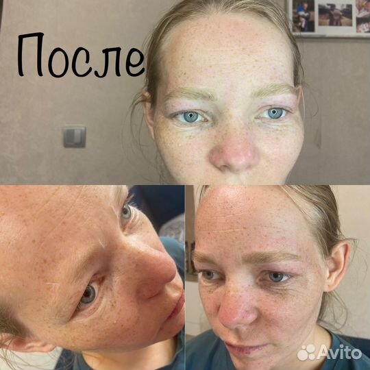 Депиляция воском