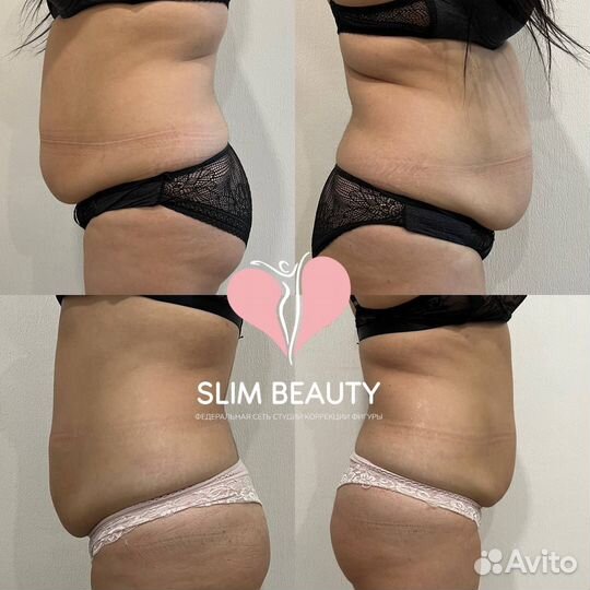 Похудеть до 10 кг за курс