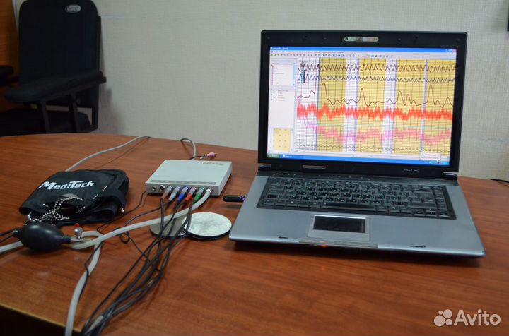 Проверки на полиграфе детекторе лжи