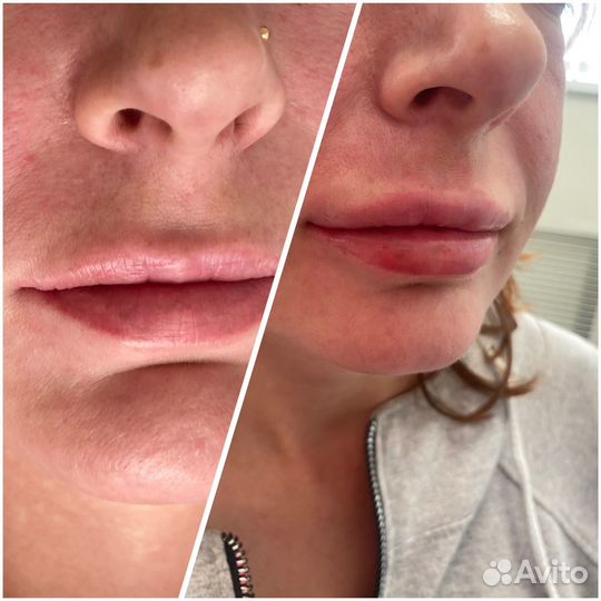 Услуги косметолога