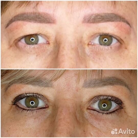 Сангапури - коррекция верхнего века