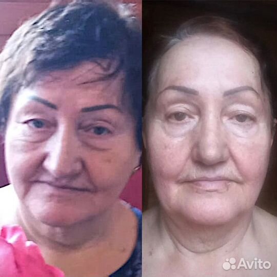 Массаж лица классический