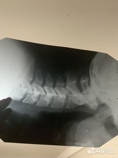 Снимок рентгеновский