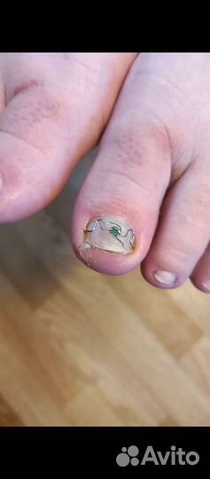 Услуги подолога. Подолог