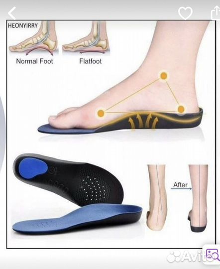 Ортопедические стельки