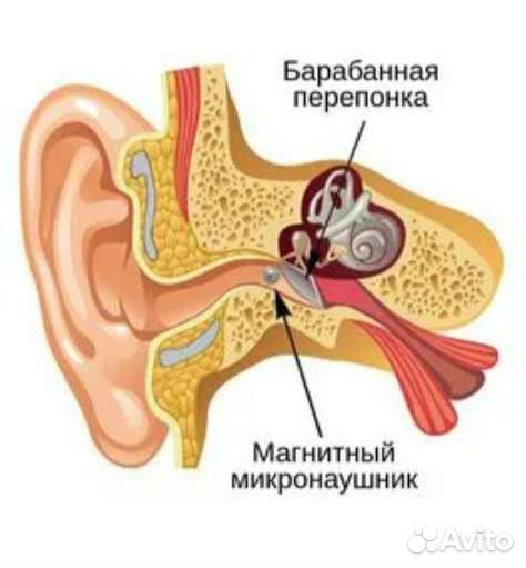 Микронаушник bluetooth с микрофоном