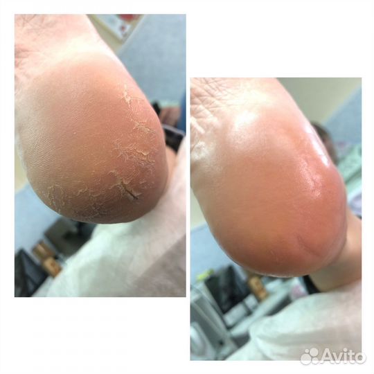 Маникюр/педикюр женский/мужской