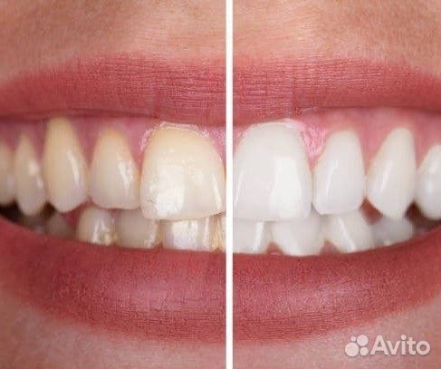 Сертификат на зубы