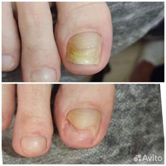 Подолог с выездом на дом