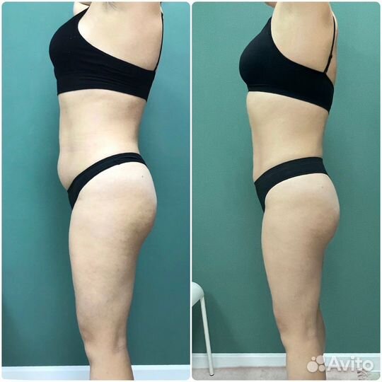 Роликовый массаж сферами