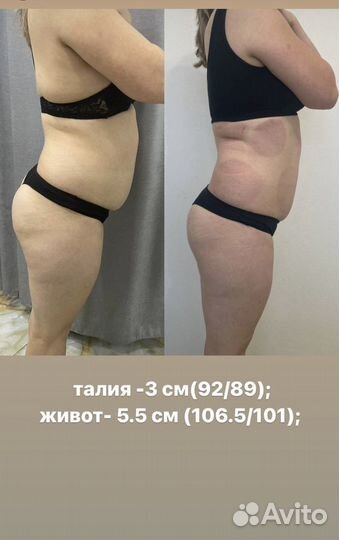 Аппаратный лимфодренажный массаж