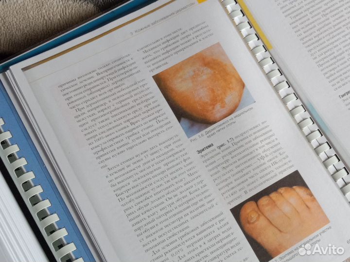 Книги по подологии - 2шт