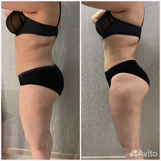 Массаж Депиляция Электроэпиляция