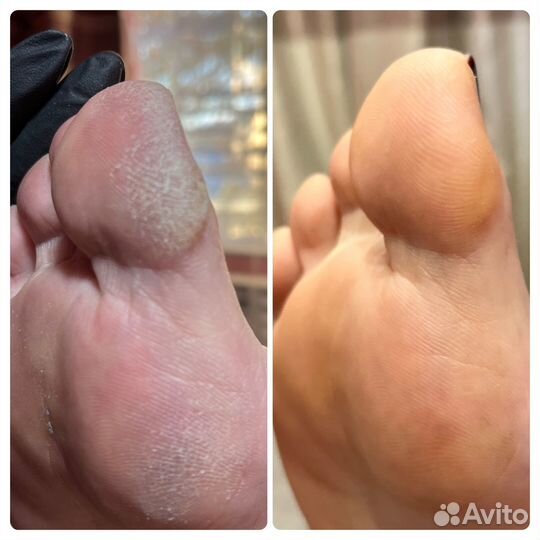 Педикюр аппаратный / Препаратный Golden Trace