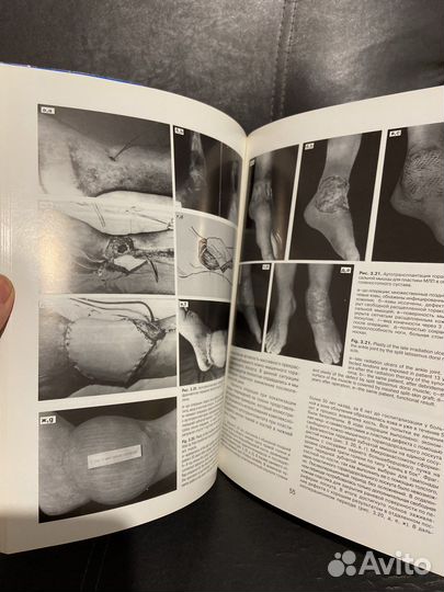 Книги по хирургии Миланов Шилов