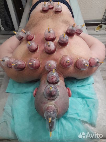 Спортивный массаж