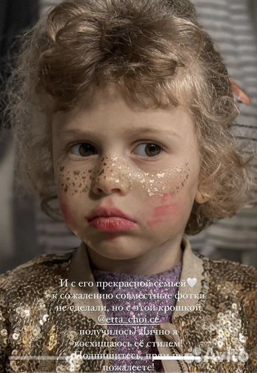 Веснушки на лицо переводные