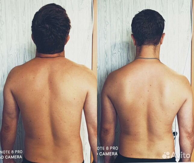 Массаж Челябинск (реабилитолог)