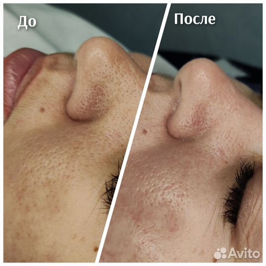 Услуги косметолога