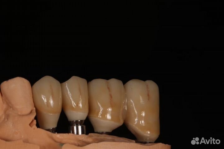 Зуботехническая лаборатория