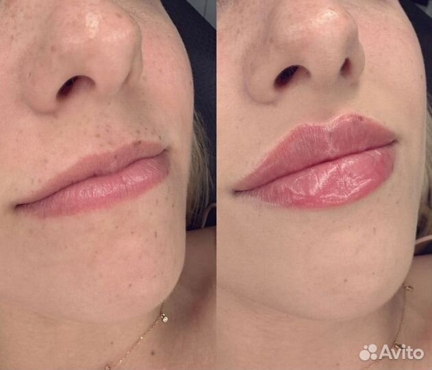 Инъекционная, аппаратная косметология