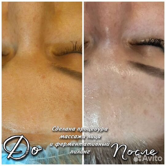 Массаж лица и косметология