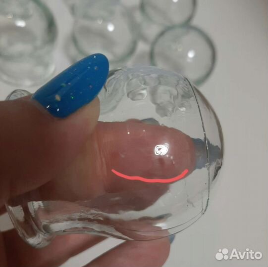 Банки стеклянные медицинские массажные СССР 8+2