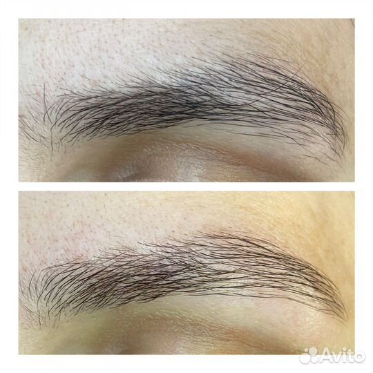 Брови/Броволог/Восстановление бровей
