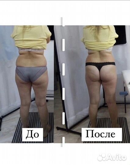 Хотите стройное тело Похудение 9 процедур